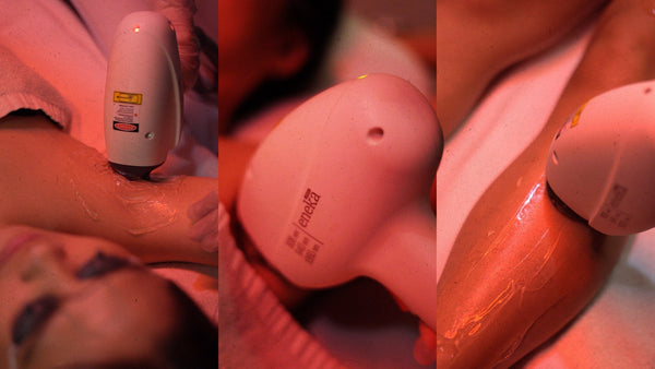 The Wait is Over: Laser Hair Removal is Finally Launching at Remedy