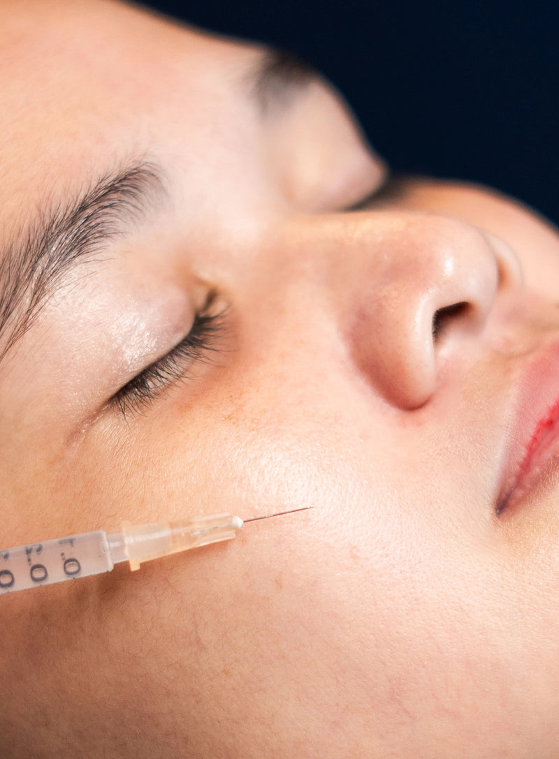 Melasma Fade