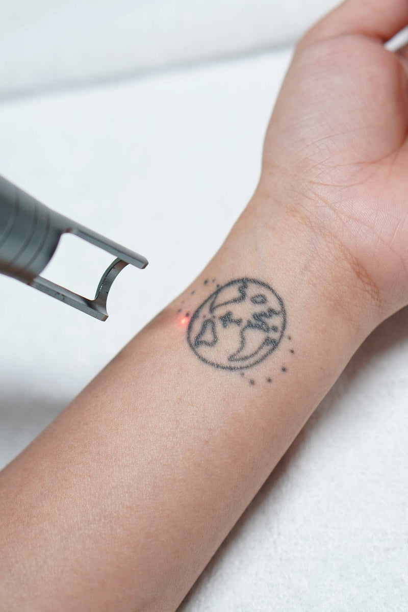 Tattoo-X