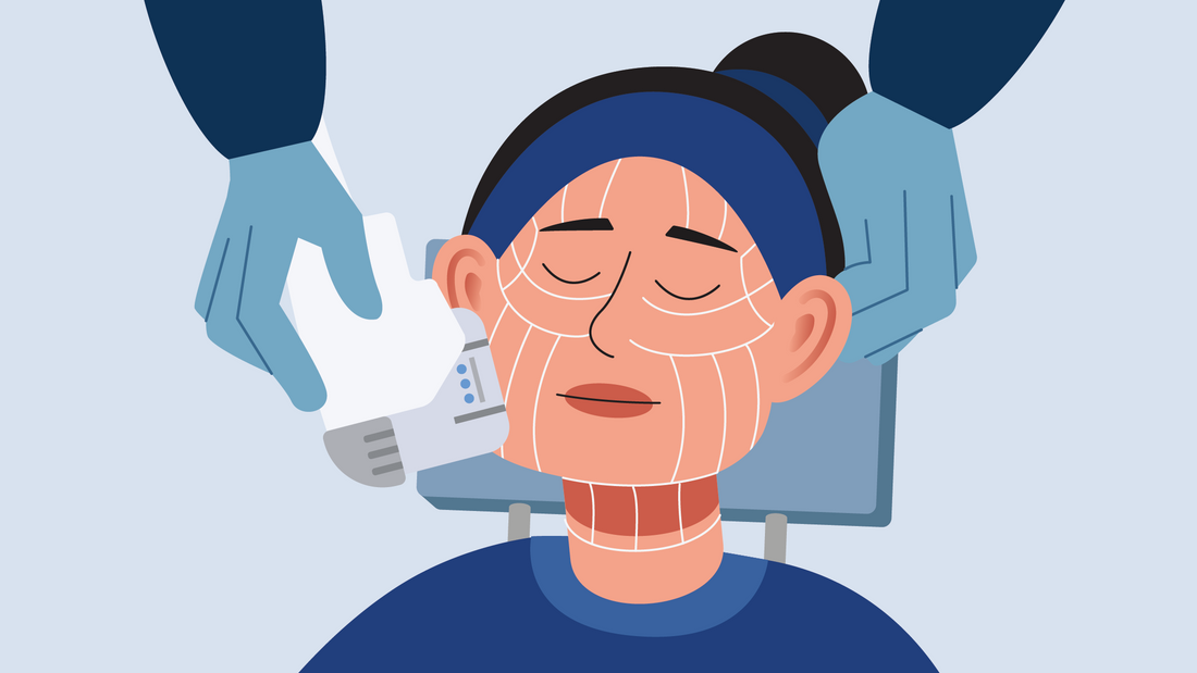 Ulthera Pro: The Gold Standard for Non-Invasive Lifting and Skin Tightening, Finally at Remedy