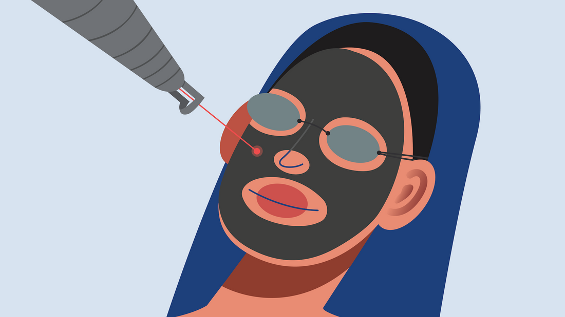 The Hollywood Laser Facial, Explained