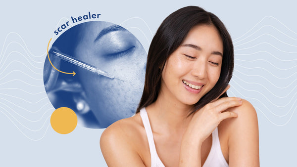 Introducing Remedy's Scar Healer: A Comprehensive Approach to Acne Scars and Skin Rejuvenation