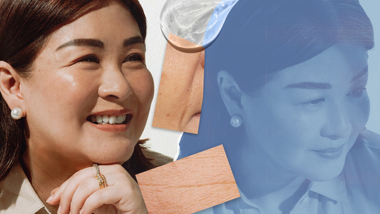 It’s Never Too Late: A Mompreneur’s Journey to Healthy Skin in Her 50s