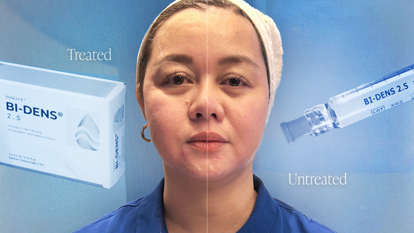 Bidens: The Skin Booster for Lifted, Redensified, and Youthful Skin