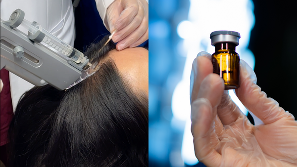 Hair Restore: Science-Backed Care for Hair Loss