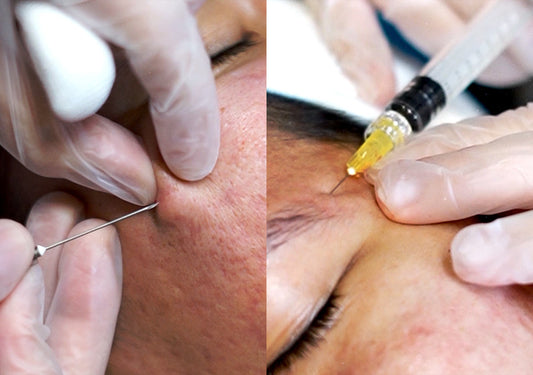 Scar Lift: The Scar Treatment That Goes Deeper and Works Smarter