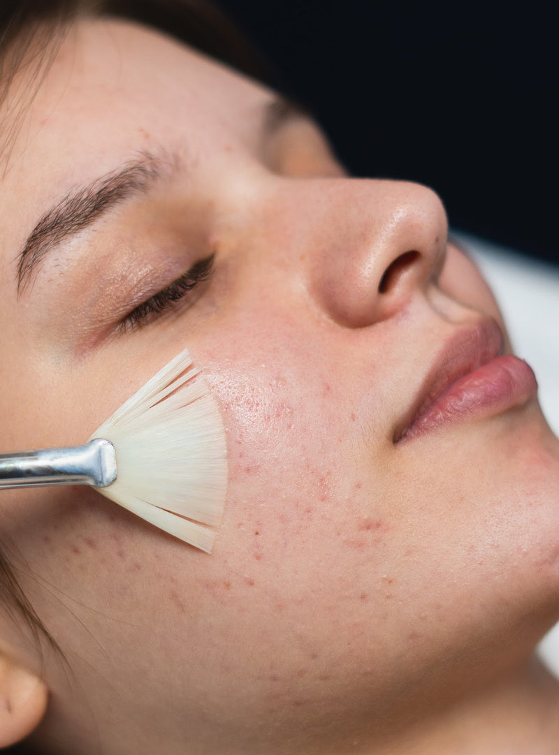 Custom Peel