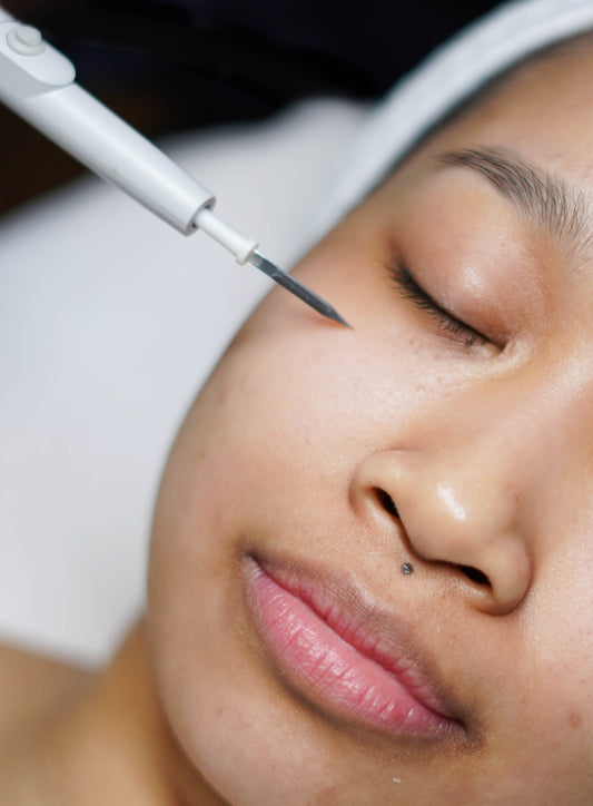 Seborrheic Keratosis Removal