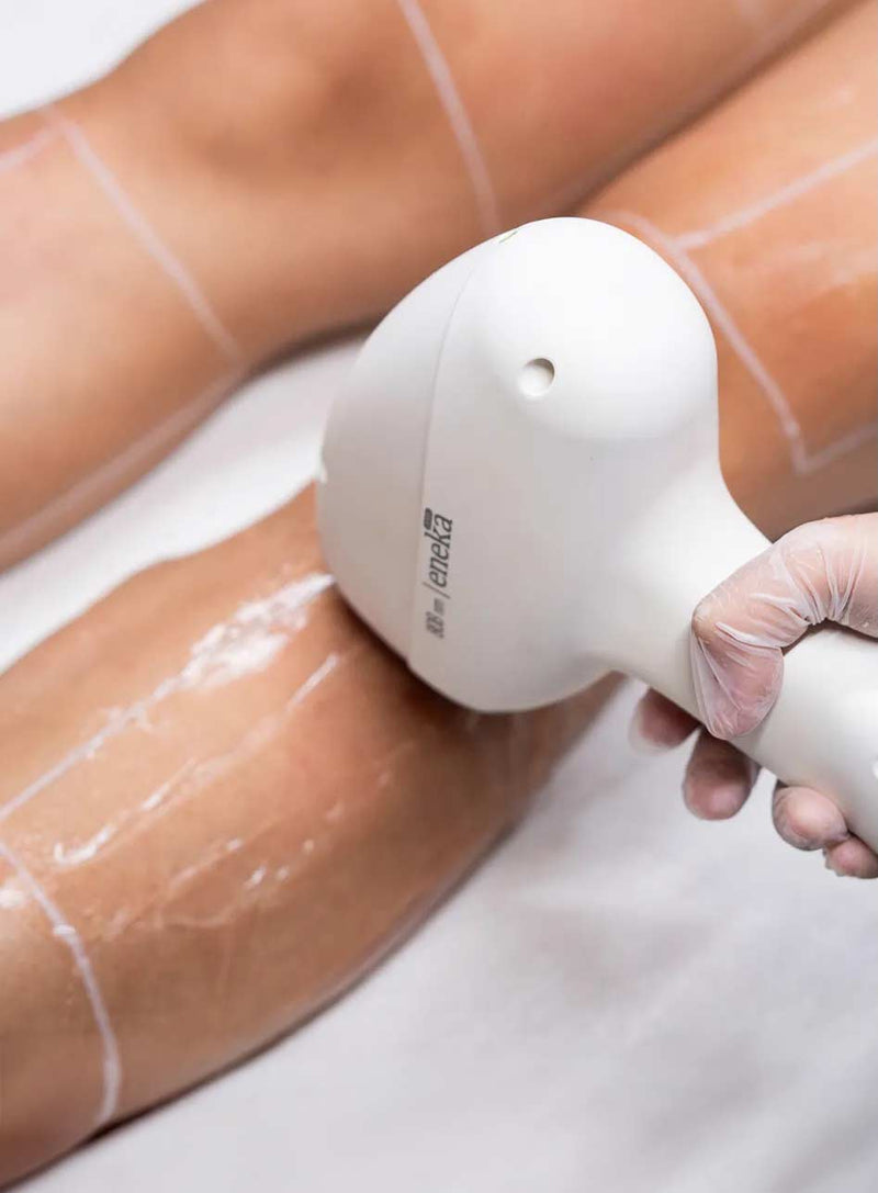 Laser Hair Removal